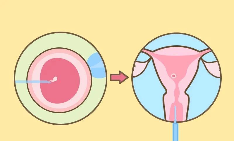 输卵管出现哪些情况会导致试管婴儿成功率低