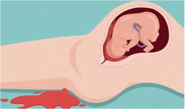 流产后如何在最短时间内有效备孕